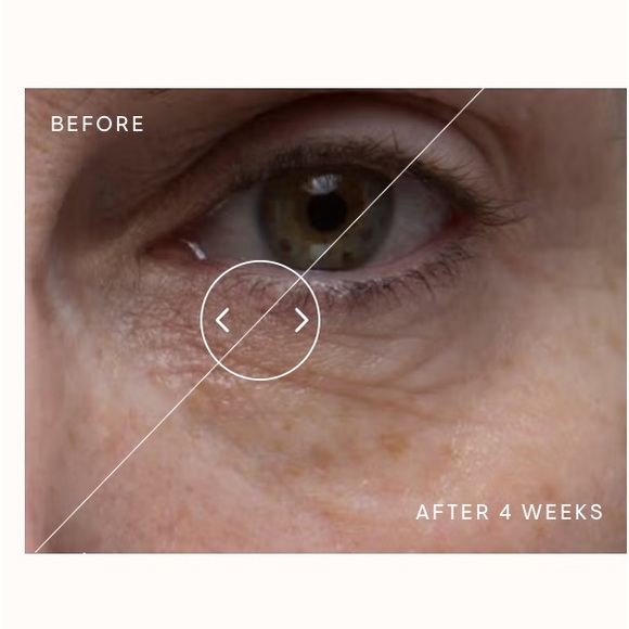 Elemis Peptide 4 Eye Recovery Cream - Picture 7 of 14